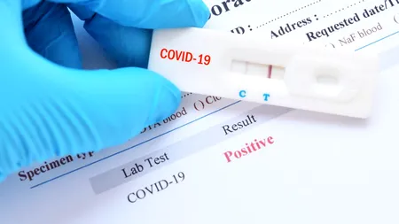 Un nou test pentru depistarea COVID-19 poate oferi rezultatul în doar 20 de minute. Cum funcționează acesta