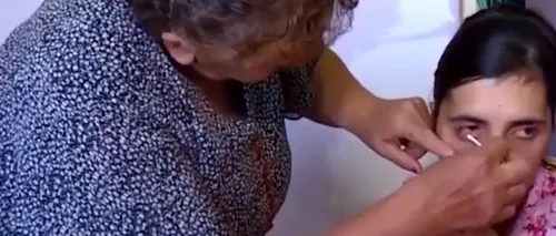Femeia care „plânge cristale: Credeau că vrea să îi înșele, dar medicii au rămas șocați când și-au dat seama că boala este reală - VIDEO 