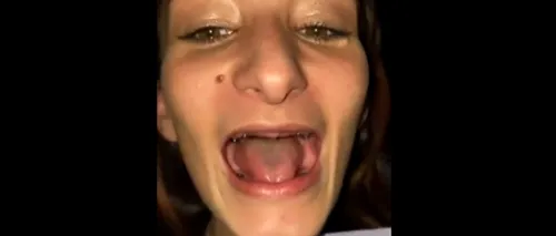 Dentistul groazei: I-a scos toți dinții din gură unei paciente! Cum arată tânăra după ce a primit o dantură nouă (VIDEO)
