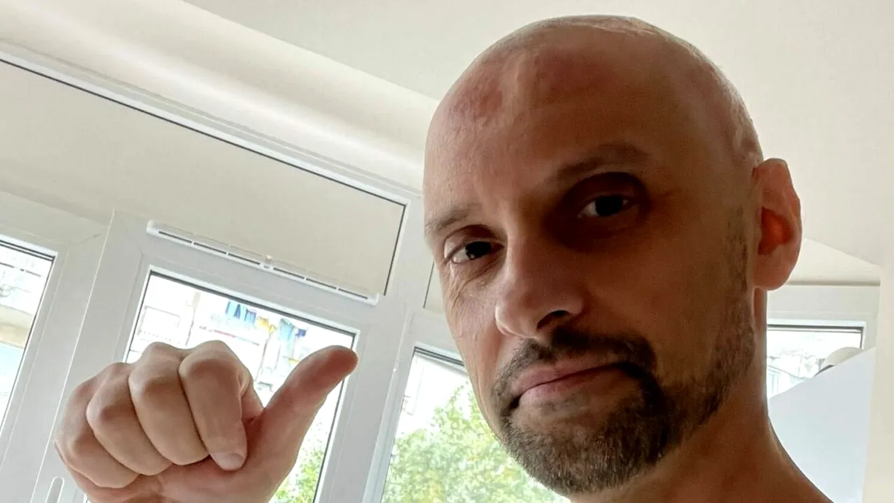 O șansă pentru Alex! Luptă cu un cancer cerebral și are nevoie de 250.000 de dolari pentru o operație în SUA