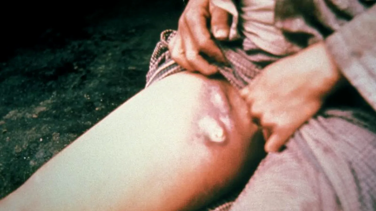 China a izolat 30.000 de oameni după ce o persoană a decedat din cauza „morții negre