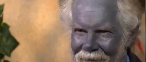 A murit Papa Smurf, singurul om cu piele albastră din lume
