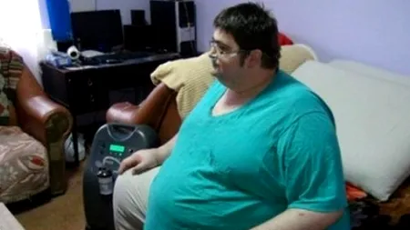Robert Cogeanu, bărbatul de 300 de kilograme, a murit în această dimineață. Ficatul lui ajunsese să cântărească 20 de kilograme