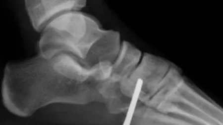 Accidentul teribil al unui tânăr karatist în timpul antrenamentelor. VIDEO