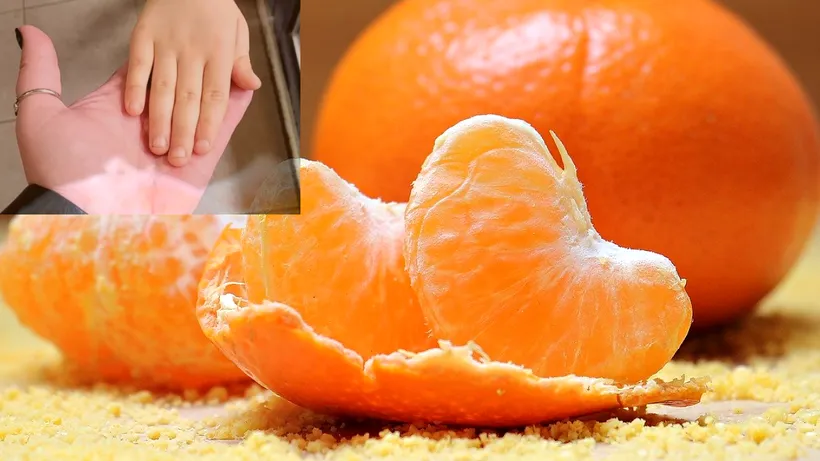 Mama unui copil a fost șocată să vadă ce a pățit fiul său: A devenit portocaliu după ce a mâncat prea multe portocale și mandarine. Ce spun medicii