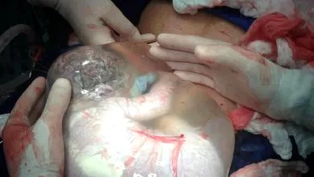 FOTO. Surpriză la naștere. Medicul: 