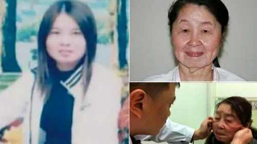O chinezoaică suferă de o boală rară care o face să pară mai bătrână cu 40 de ani