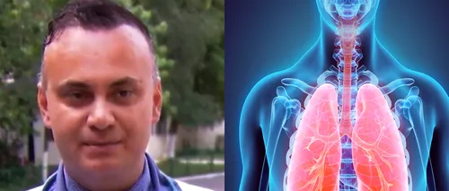 ”Sindromul plămânului alb” a ajuns și în România! Medicul Adrian Marinescu: ”O BACTERIE atipică!”