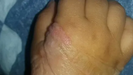 Asistentele unui spital, acuzate că au ignorat un copil: „Mi-au NENOROCIT băiețelul, din cauză că nu au ele chef. Mirosea a PUTREZIT!