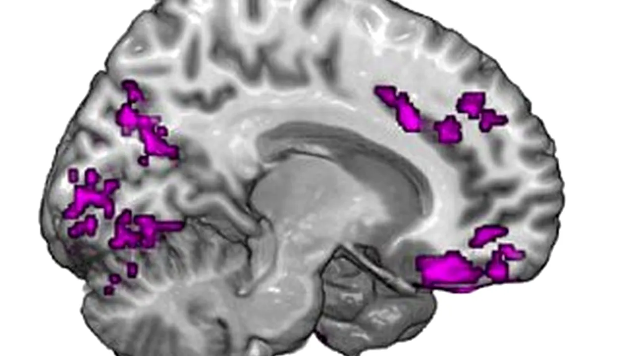 Legătura dintre consumul de cocaină și forma creierului. STUDIU