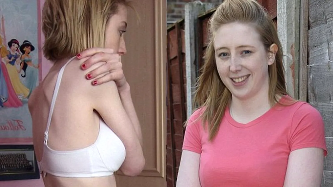 ANOREXIA face victime. Cazul unei adolescente NORMALE care a vrut să arate ca DIVELE din reviste