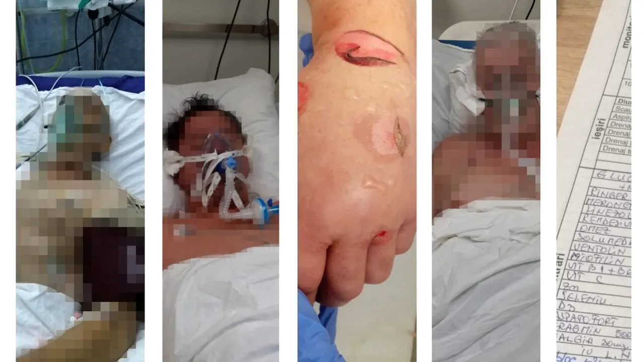 Un medic din Sibiu dezvăluie ce se întâmplă într-o secție ATI. „Oamenii sunt sedați, răstigniți ca vitele, legați de paturi!”