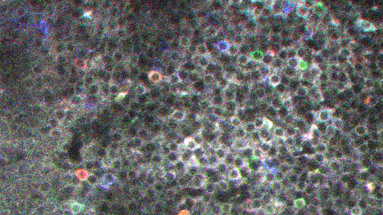 Unde păstrează creierul amintirile 