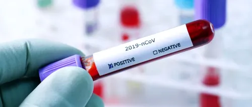 RECORD NEGATIV pentru România: 30 de noi cazuri într-o singură zi. Bilanțul a crescut la 89 de români infectați cu coronavirus