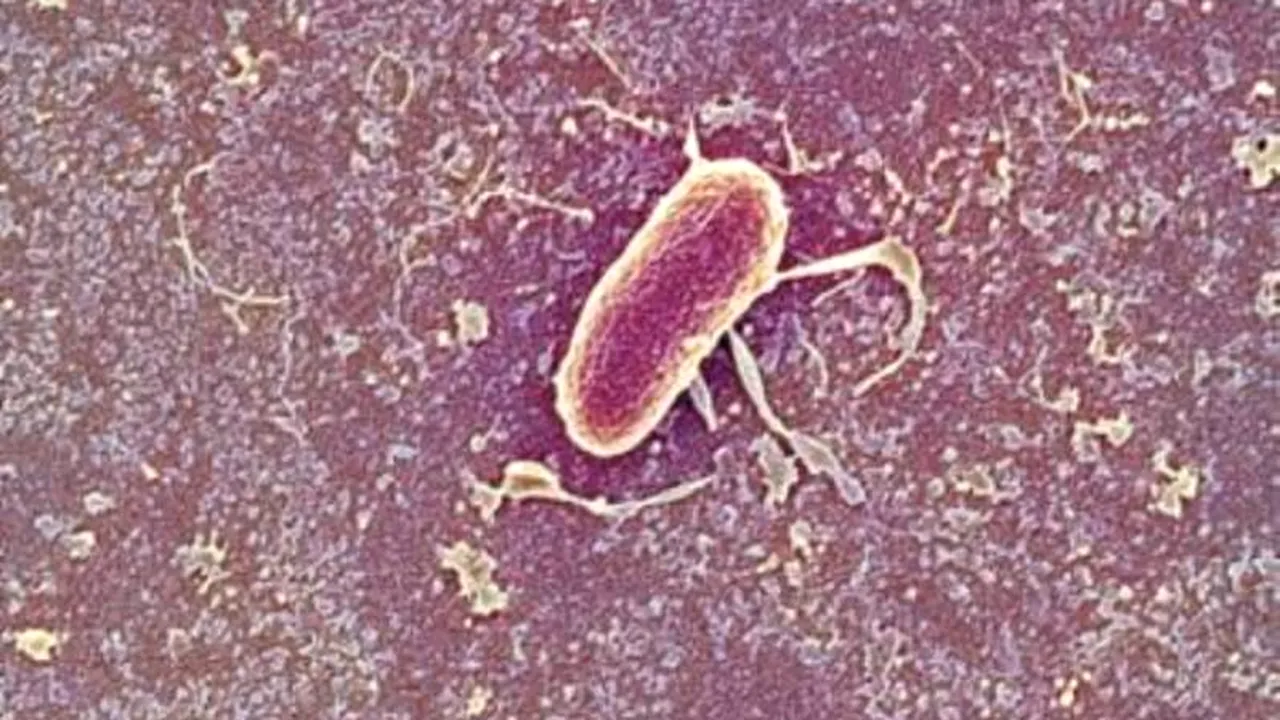 Bacteriile care protejează împotriva alergiilor alimentare