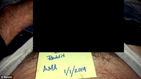 Un bărbat cu două penisuri s-a destăinuit pe Reddit: 