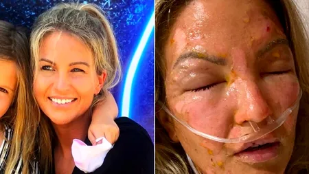 Riscul nebănuit la care se supun multe gospodine. Ce a pățit o femeie din Texas, lecție pentru toți!