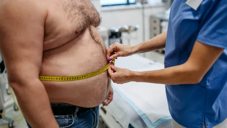 Câte CALORII are un kilogram de grăsime. Ce număr de calorii trebuie să arzi pentru a slăbi un kilogram și cum o poți face mai eficient