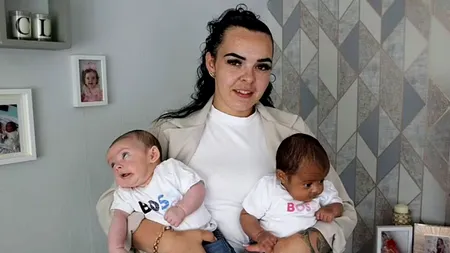 Povestea gemenilor care s-au născut având culori diferite ale pielii. Care este explicația mamei lor