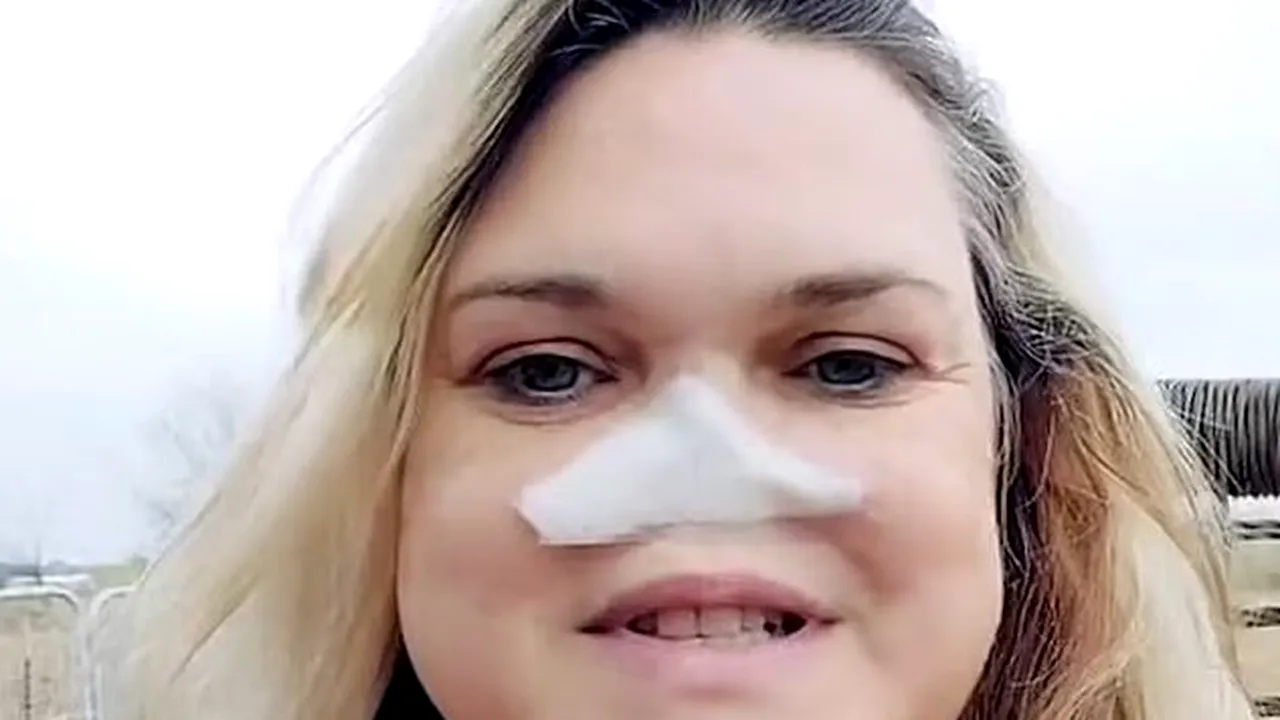 Caz extrem de rar! Cum trăiește femeia fără NAS. „Piperul, dușmanul meu numărul 1”