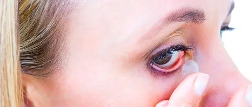 VIDEO O femeie a ajuns la urgențe după ce după ce a adormit cu lentilele de contact pe ochi. Medicii au fost șocați de ceea ce au descoperit în ochii femeii
