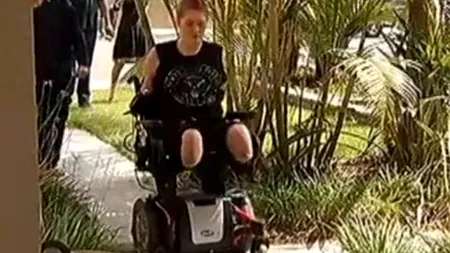 Povestea tinerei care a învins boala după 20 de operații în care i-au fost amputate mâinile și picioarele. VIDEO