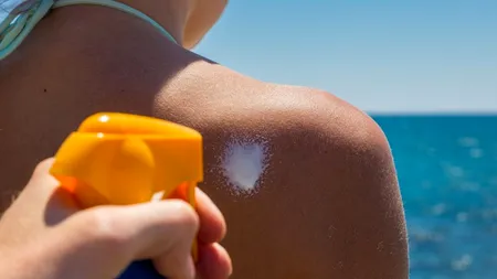 Sfaturi pentru a scăpa rapid de ARSURILE solare. Un important pas în lupta pentru prevenirea cancerului de piele