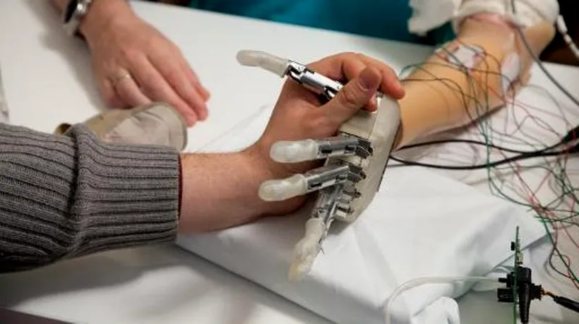 O mână bionică le redă persoanelor cu dizabilități simțul tactil