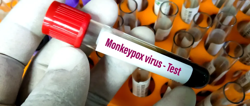Spania anunță încă un mort din cauza variolei maimuței