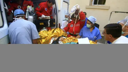 O femeie a ajuns la spital cu arsuri pe 80% din corp, în urma unei explozii produse la o casă din Prahova