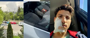 Un tânăr din Câmpina, MUTILAT în parcare. Agresorul i-a spart geamul mașinii cu o sticlă de bere și a fugit. ”Am văzut cioburi și cum sărea sângele”