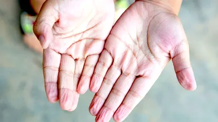 Motivul pentru care se încrețesc degetele dacă stăm prea mult în apă