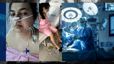 EXCLUSIV | Cazul femeii care era să moară după ce și-a redus stomacul în Turcia, anchetat de polițiștii români