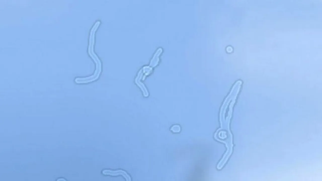 Motivul fascinant pentru care vezi ocazional pete minuscule plutind în ochi