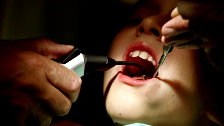 Vara, orașul Iași devine destinație de top pentru tratamente DENTARE ale românilor plecați din țară. „Diferențele de preț pot ajunge și la 50–70%”