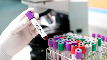 OMS: Decesele zilnice cauzate de COVID-19 în Europa au crescut cu 40%