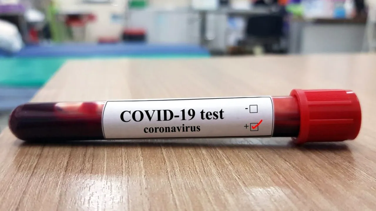 Un profesor din Iași, confirmat cu COVID-19. El ar fi intrat în contact cu zeci de colegi. / Cele patru scenarii în cazul îmbolnăvirii cadrelor didactice