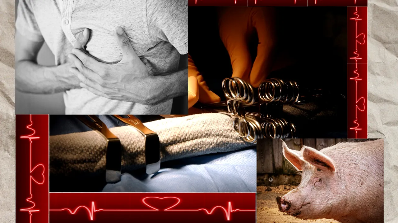 Ce a pățit al doilea om din lume care a primit o inimă de PORC. Corpul său a reacționat violent după operație