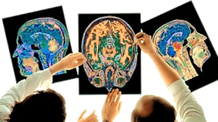 STUDIU. Vârsta la care creierul ajunge la maturitate