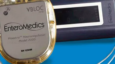 Agenția americană pentru medicamente a autorizat comercializarea unui implant contra obezității. Cum funcționează revoluționarul dispozitiv