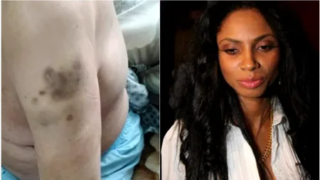 ACUZAȚII. Fotomodelul Laurette și-a externat bunicul plin de vânătăi din Spitalul Județean Brăila: 