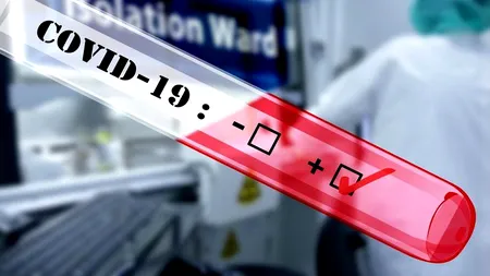 Rata de infectare cu Covid-19 dintr-o localitate botoșăneană este de peste 10 la mie