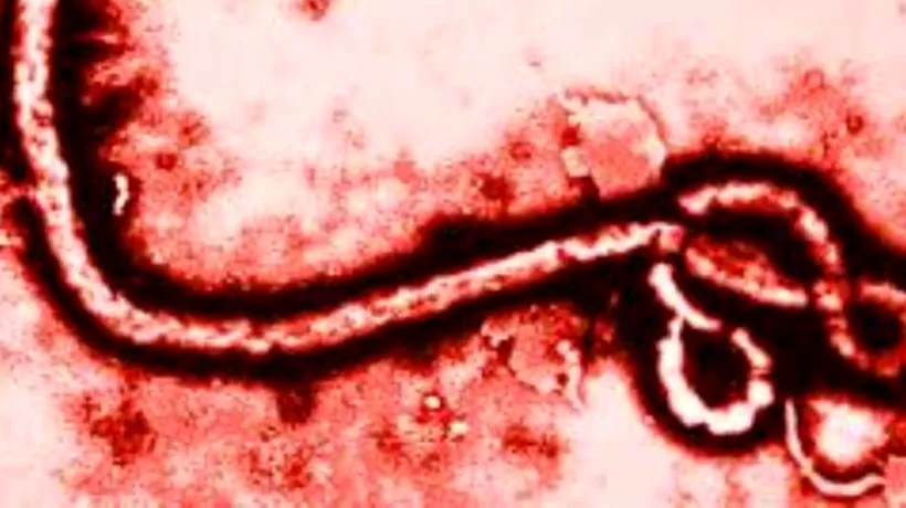 Britanicul decedat în Macedonia prezenta simptome asemănătoare celor ale Ebola