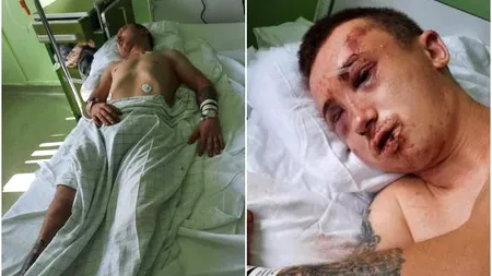 Un tânăr din Arad, la un pas de moarte. A fost bătut cu bestialitate, dezbracat și abandonat pe un trotuar