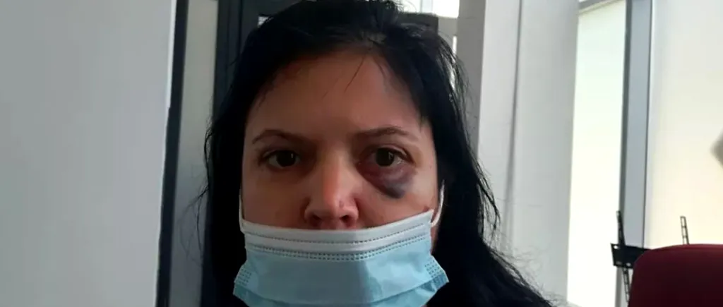 ȘOCANT. Femeie din Iași, bătută cu sălbăticie în fața copilului de trei ani: „M-a lovit, m-a strâns de gât cu mâna, forțându-mă să vând apartamentul”