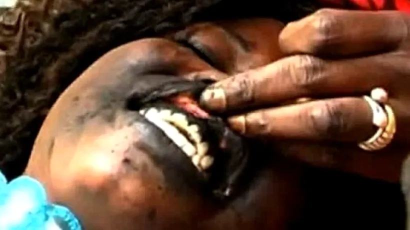 Tratamentul de înfrumusețare sau tortură? Până unde merg femeile din Senegal pentru a avea un zâmbet de invidiat. VIDEO