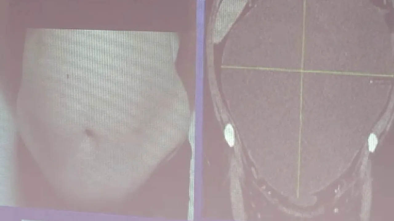 Surpriza unei femei din Constanța care a crezut că este gravidă