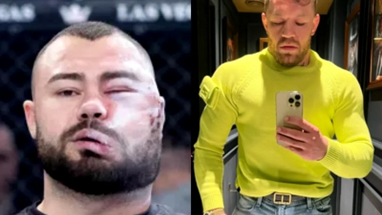 Conor McGregor, mesaj pentru românul care s-a lăsat desfigurat pentru 5.000 de euro. Cum se simte acum Sorin Comșa, campionul concursului de dat palme