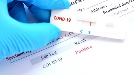 Șoc internațional: Testele standard pentru diagnosticarea COVID, invalidate de instanța portugheză: „Probabilitatea ca rezultatul să fie fals pozitiv este de 97%”