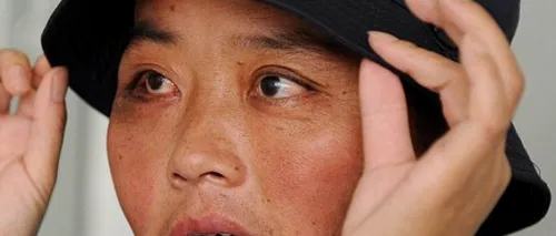 Cum arată o femeie din China înainte ca medicii să-i îndepărteze 70 de tumori de pe față

